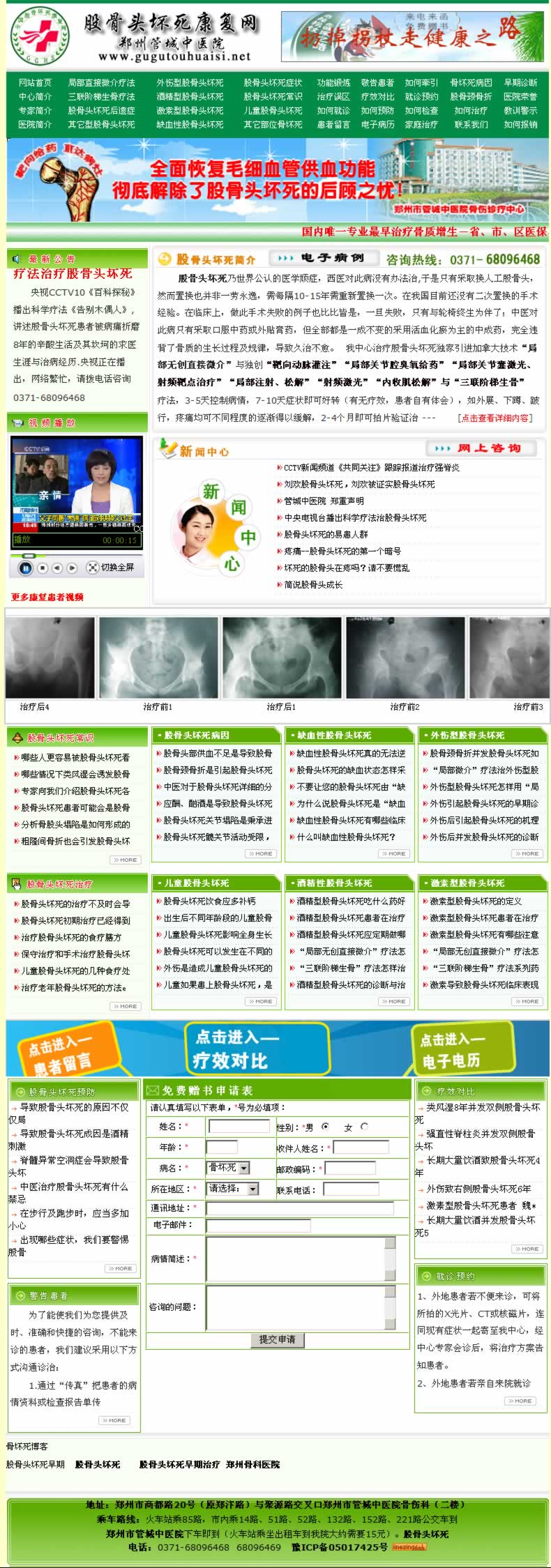 管城中醫(yī)院骨壞死康復網 管城中醫(yī)院骨壞死康復網